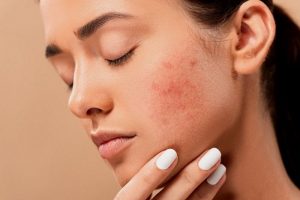 Kamu Wajib Tahu! Skincare untuk Skin Barrier yang Ampuh